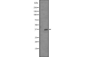 Western blot analysis of OR52Z1P expression in K562 cell line lysates ;,The lane on the left is treated with the antigen-specific peptide. (OR52Z1 抗体)