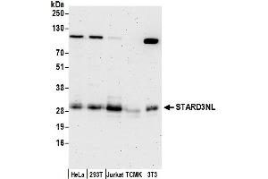 anti-STARD3 N-Terminal Like (STARD3NL) (AA 184-234) antibody