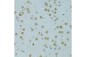 Immunohistochemistry of paraffin-embedded rat brain using MUS81 antibody (ABIN6132372, ABIN6144202, ABIN6144203 and ABIN6222560) at dilution of 1:100 (40x lens). (MUS81 抗体  (AA 1-350))