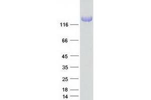 Western Blotting (WB) image for Neurofascin (NFASC) (Transcript Variant 2) protein (Myc-DYKDDDDK Tag) (ABIN2727124)