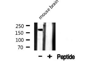 Western Blotting (WB) image for anti-Microtubule-Associated Protein 2 (MAP2) (N-Term) antibody (ABIN6263097)