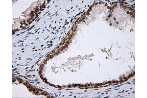 Immunohistochemical staining of paraffin-embedded colon tissue using anti-SHC1 mouse monoclonal antibody. (SHC1 抗体)