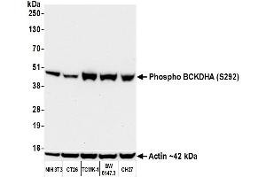 Western Blotting (WB) image for anti-Branched Chain Keto Acid Dehydrogenase E1, alpha Polypeptide (BCKDHA) (pSer292) antibody (ABIN7449282) (Recombinant BCKDHA 抗体  (pSer292))