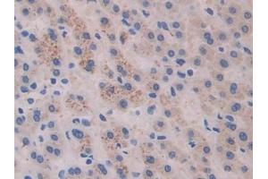 Immunohistochemistry (IHC) image for anti-Cross-Linked C-Telopeptides of Type I Collagen (CTX-I) antibody (ABIN7427822)