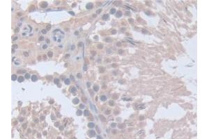Detection of ITSN1 in Rat Testis Tissue using Polyclonal Antibody to Intersectin 1 (ITSN1) (ITSN1 抗体  (AA 1-227))