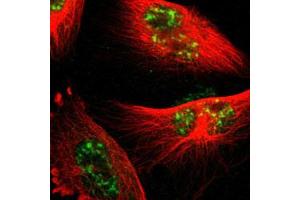 Immunofluorescent staining of U-251 MG with PML polyclonal antibody  (Green) shows positivity in nucleus but excluded from the nucleoli. (PML 抗体)