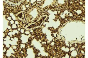 ABIN6267141 at 1/100 staining Mouse lung tissue by IHC-P. (MST1 抗体  (pThr183))