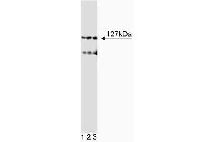 Western blot analysis of Adaptin epsilon on SK-MEL5 lysate. (AP4E1 抗体  (AA 685-793))