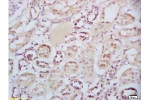 Formalin-fixed and paraffin embedded human kidney labeled with Rabbit Anti-Sclerostin Polyclonal Antibody, Unconjugated (ABIN1714867) at 1:200 followed by conjugation to the secondary antibody and DAB staining (Sclerostin 抗体  (AA 121-180))