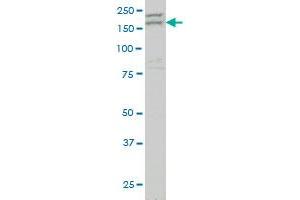 AATK monoclonal antibody (M04), clone 2C8 Western Blot analysis of AATK expression in NIH/3T3 . (AATK 抗体  (AA 161-260))