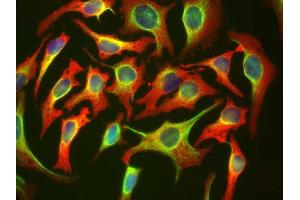 HeLa cells staining with ABIN1580426 (red), and counterstained with ’s chicken polyclonal antibody to Vimentin CPCA-Vim (green) and DNA (blue). (HSP27 抗体)