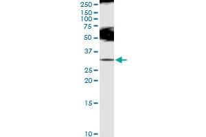 Immunoprecipitation of SLC5A1 transfected lysate using anti-SLC5A1 MaxPab rabbit polyclonal antibody and Protein A Magnetic Bead , and immunoblotted with SLC5A1 MaxPab rabbit polyclonal antibody (D01) (SLC5A1 抗体  (AA 1-664))