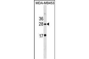 Western blot analysis in MDA-MB453 cell line lysates (35ug/lane). (CLDN14 抗体  (C-Term))