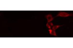 ABIN6268984 staining 293 cells by IF/ICC. (Caspase 1 抗体  (pSer376))