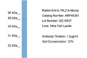 WB Suggested Anti-IL1RL2  Antibody Titration: 0. (IL1RL2 抗体  (N-Term))