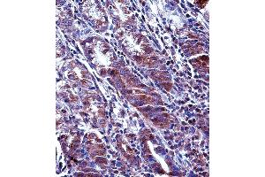 MCL1 Antibody (Center) (ABIN657627 and ABIN2846623) immunohistochemistry analysis in formalin fixed and paraffin embedded human stomach tissue followed by peroxidase conjugation of the secondary antibody and DAB staining. (MCL-1 抗体  (AA 217-245))