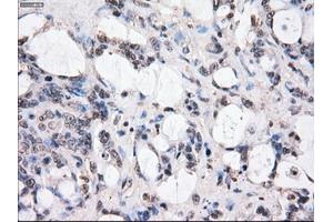 Image no. 2 for anti-Budding Uninhibited By Benzimidazoles 1 Homolog beta (Yeast) (BUB1B) antibody (ABIN1496995) (BUB1B 抗体)