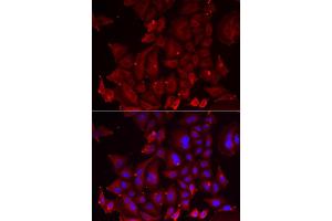 Immunofluorescence analysis of U2OS cell using PANX1 antibody. (PANX1 抗体)