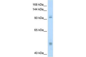 Western Blotting (WB) image for anti-Nuclear Factor of kappa Light Polypeptide Gene Enhancer in B-Cells 1 (NFKB1) antibody (ABIN2461714) (NFKB1 抗体)