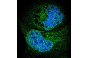 Immunofluorescent staining of A-431 cells with SYVN1 polyclonal antibody  (Green) shows positivity in endoplasmic reticulum and nucleus but excluded from the nucleoli. (SYVN1 抗体)