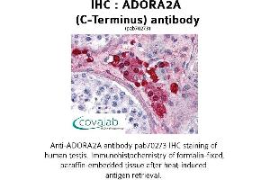 Image no. 1 for anti-Adenosine A2a Receptor (ADORA2A) (C-Term), (Cytoplasmic Domain) antibody (ABIN1731565)