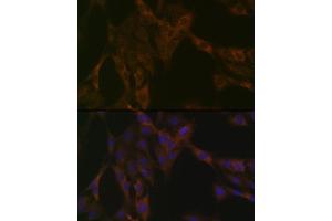Immunofluorescence analysis of C6 cells using DDX6 Rabbit mAb (ABIN7266703) at dilution of 1:100 (40x lens). (DDX6 抗体)