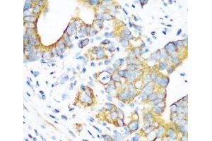 Immunohistochemistry of paraffin-embedded Human stomach using MTCO2 Polyclonal Antibody at dilution of 1:100 (40x lens). (COX2 抗体)