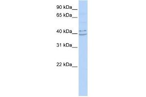 WB Suggested Anti-PYHIN1 Antibody Titration:  0. (PYHIN1 抗体  (N-Term))