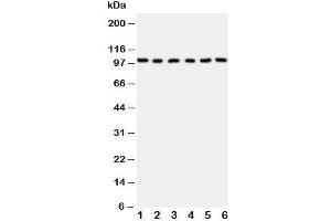 Western blot testing of MCM2 antibody and Lane 1:  rat testis;  2: (r) kidney;  3: mouse intestine;  4: (m) testis;  5: (m) ovary;  6: (m) kidney (MCM2 抗体  (AA 884-904))