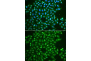 Immunofluorescence analysis of A549 cell using UCHL5 antibody. (UCHL5 抗体)