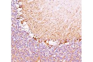 IHC testing of cerebellum stained with Neurofilament Heavy antibody (RT97). (NEFH 抗体)