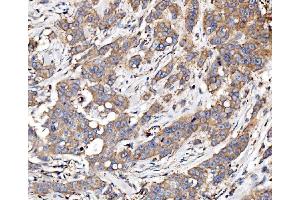 IHC analysis of Glycogen synthase 1/GYS1 using anti-Glycogen synthase 1/GYS1 antibody (ABIN7602155). (Glycogen Synthase 1 抗体  (AA 60-640))
