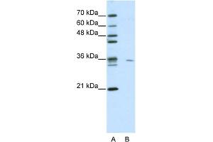 WB Suggested Anti-MDS032 Antibody Titration:  0. (Use1 抗体  (N-Term))