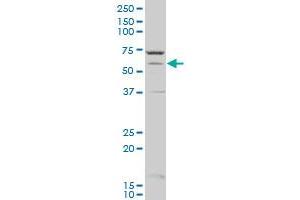 CYP1A2 polyclonal antibody (A01), Lot # 051122JC01 Western Blot analysis of CYP1A2 expression in A-431 . (CYP1A2 抗体  (AA 211-310))