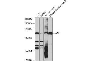 Western blot analysis of extracts of various cell lines, using AGL antibody (ABIN6131508, ABIN6136632, ABIN6136633 and ABIN6214165) at 1:1000 dilution. (AGL 抗体  (AA 1233-1532))