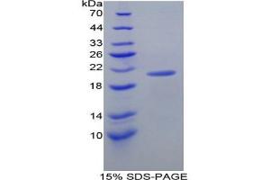 SDS-PAGE analysis of Mouse Diamine Oxidase Protein. (DAO 蛋白)