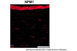 Sample Type: human cornea (frozen)Blue: DAPIRed: NPM1Primary Dilution: 1:100Image Submitted By: Geraint ParfittGavin Herbert Eye Institute . (NPM1 抗体  (C-Term))