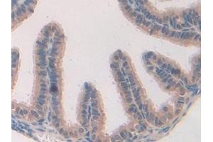 Detection of CARD9 in Mouse Oviduct Tissue using Polyclonal Antibody to Caspase Recruitment Domain Family, Member 9 (CARD9) (CARD9 抗体  (AA 274-530))