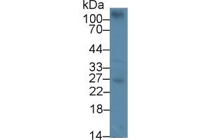 Detection of CEBPd in Mouse Spleen lysate using Polyclonal Antibody to CCAAT/Enhancer Binding Protein Delta (CEBPd) (CEBPD 抗体  (AA 51-251))