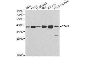 Western Blotting (WB) image for anti-Cyclin-Dependent Kinase 9 (CDK9) (AA 153-372) antibody (ABIN3015519)