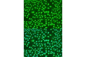 Immunofluorescence analysis of U2OS cells using PSEN2 antibody. (Presenilin 2 抗体)