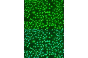 Immunofluorescence analysis of U2OS cells using PSEN2 antibody. (Presenilin 2 抗体)