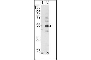 Western blot analysis of ALS2CR2 (arrow) using ALS2CR2 Antibody (STRADB 抗体  (C-Term))