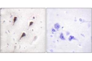 Immunohistochemistry analysis of paraffin-embedded human brain tissue, using WAVE1 (Ab-125) Antibody. (WASF1 抗体  (AA 91-140))