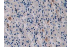 Used in DAB staining on fromalin fixed paraffin- embedded brain tissue (Aggrecan 抗体  (AA 587-684))