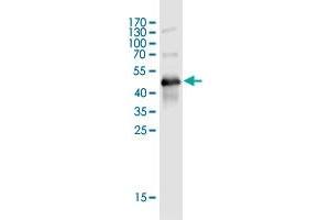 Western Blot detection against Immunogen (50 KDa) . (TMEM179B 抗体  (AA 1-219))