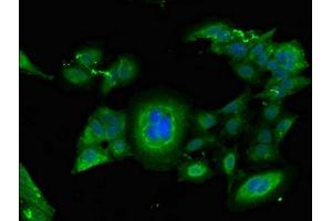 Immunofluorescent analysis of Hela cells using ABIN7152763 at dilution of 1:100 and Alexa Fluor 488-congugated AffiniPure Goat Anti-Rabbit IgG(H+L) (FGG 抗体  (AA 278-437))