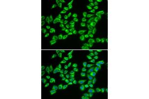 Immunofluorescence analysis of A549 cells using HADHB antibody (ABIN5973344). (HADHB 抗体)