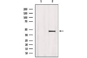 Western blot analysis of extracts from Rat heart, using BBS5 Antibody. (BBS5 抗体  (C-Term))
