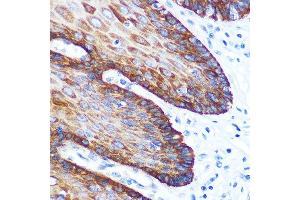 Immunohistochemistry of paraffin-embedded human esophageal using GM130 Rabbit mAb (ABIN7267494) at dilution of 1:100 (40x lens). (Golgin A2 (GOLGA2) 抗体)